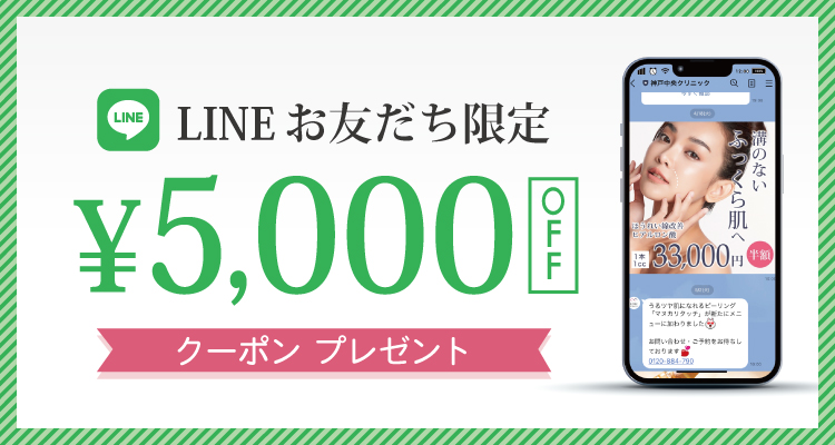 LINEお友達限定