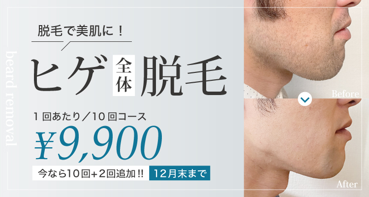 メンズ脱毛