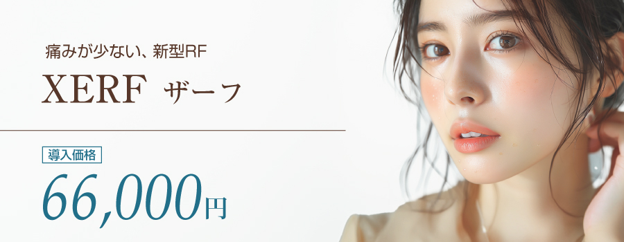 XERF ザーフ