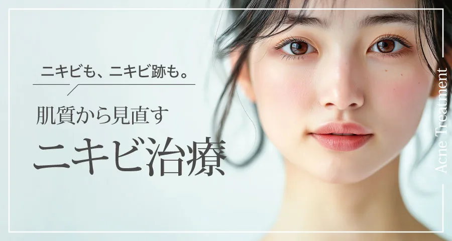 ニキビ治療