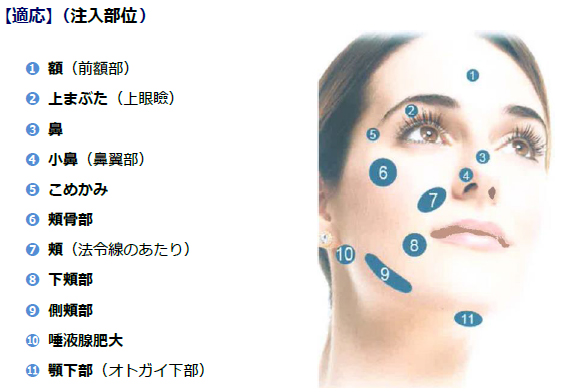 小顔BNLS対象部位
