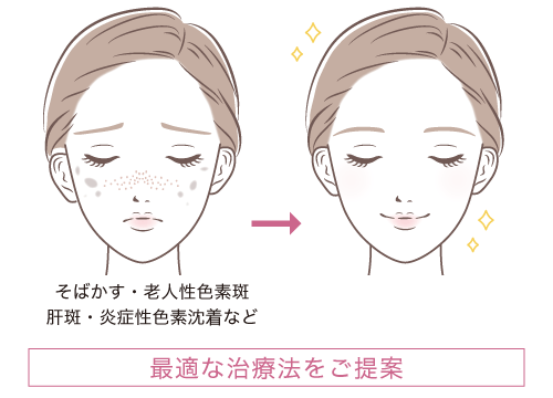 最適な治療法をご提案