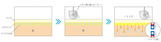 イオン導入