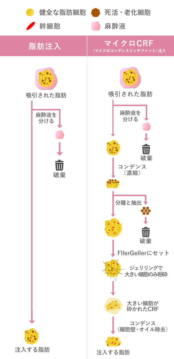 マイクロCRF