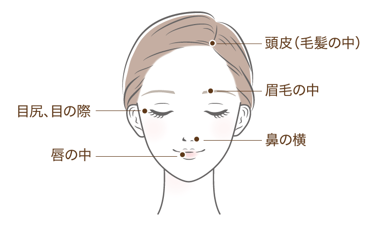 治療対象部位（顔）