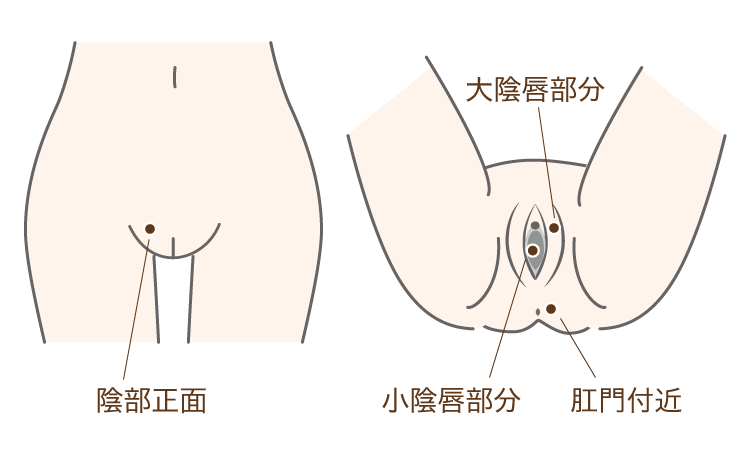 治療対象部位（体）