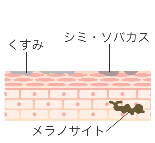 ピコトーニング治療イメージ