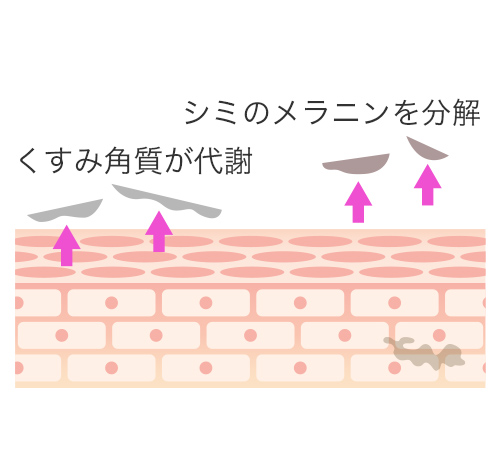 ピコトーニング治療イメージ