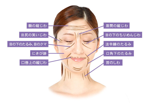 PRP再生療法対象部位