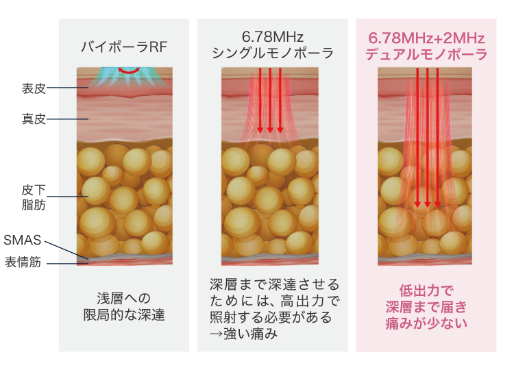 マルチ周波数テクノロジー