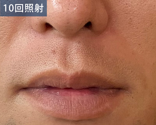 10回目