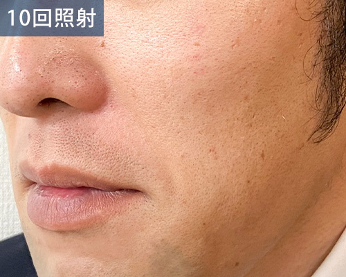 10回目
