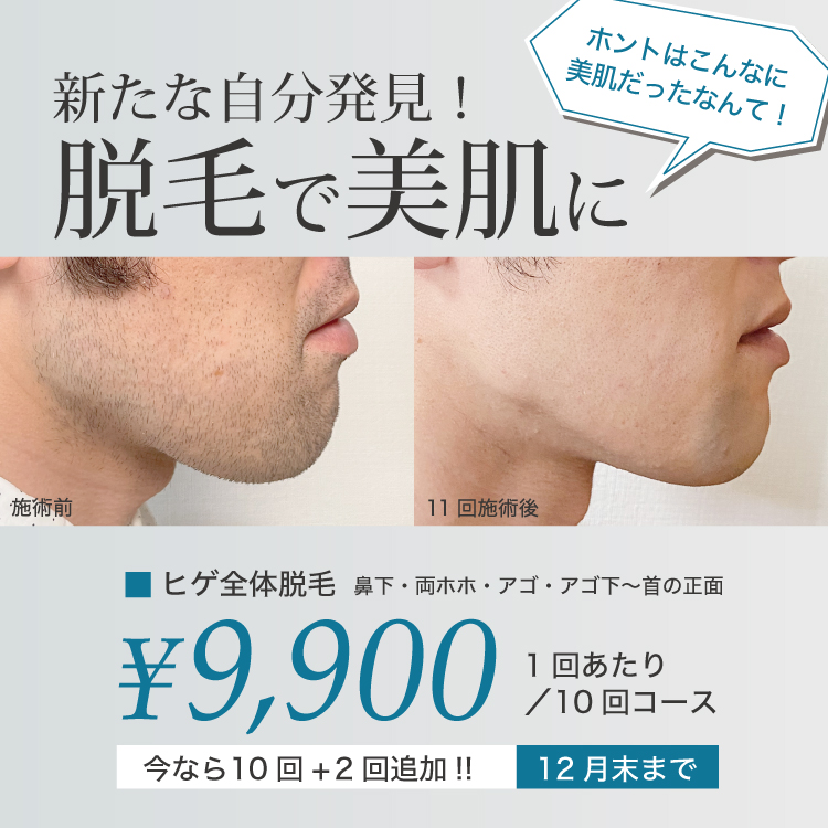 男性脱毛